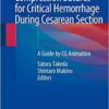 Compression Sutures for Critical Hemorrhage During Cesarean Section: A Guide by CG Animation 1st ed. 2020 Edition PDF