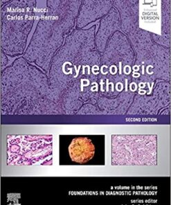 Gynecologic Pathology: A Volume in Foundations in Diagnostic Pathology Series 2nd Edition PDF