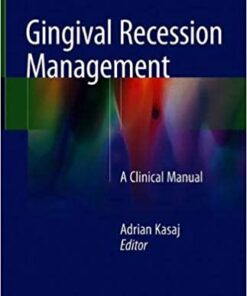 Gingival Recession Management: A Clinical Manual 1st ed. 2018 Edition PDF