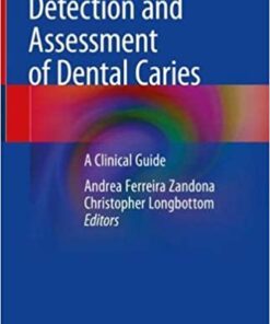 Detection and Assessment of Dental Caries: A Clinical Guide 1st ed. 2019 Edition PDF