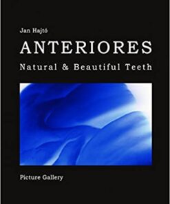 Anteriores: Natural & Beautiful Teeth: Picture Gallery PDF