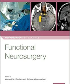 Functional Neurosurgery (Neurosurgery by Example) 1st Edition PDF