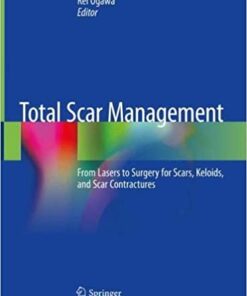 Total Scar Management: From Lasers to Surgery for Scars, Keloids, and Scar Contractures 1st ed. 2020 Edition PDF