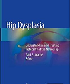 Hip Dysplasia: Understanding and Treating Instability of the Native Hip 1st ed. 2020 Edition PDF