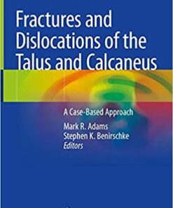 Fractures and Dislocations of the Talus and Calcaneus: A Case-Based Approach 1st ed. 2020 Edition PDF