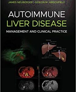 Autoimmune Liver Disease: Management and Clinical Practice 1st Edition PDF