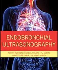 Endobronchial Ultrasonography 2nd Edition PDF