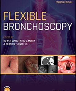 Flexible Bronchoscopy 4th Edition PDF