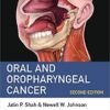 Oral and Oropharyngeal Cancer 2nd Edition PDF