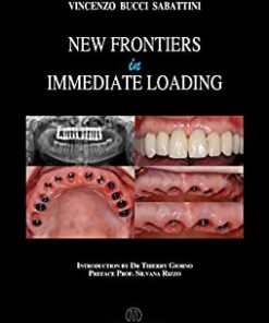 New Frontiers In Immediate Loading PDF