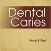 DENTAL CARIES 1st Edition PDF