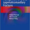 Management of Orbito-zygomaticomaxillary Fractures 1st ed. 2020 Edition PDF