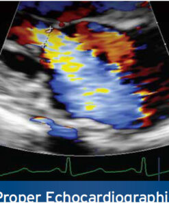 ASE: Proper Echocardiographic Measurements: How & Why 2nd Edition