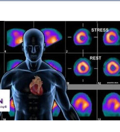 Nuclear Cardiology Board Review 2018