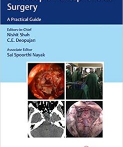 Endoscopic Transsphenoidal Surgery: A Practical Guide