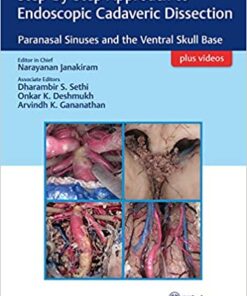 Step By Step Approach To Endoscopic Cadaveric Dissection Paranasal Sinuses And The Ventral Skull Base