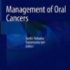 Management of Oral Cancers PDF