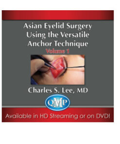 Asian Aesthetic Surgery Techniques, Volume 1: Asian Eyelid Surgery Using the Versatile Anchor Technique