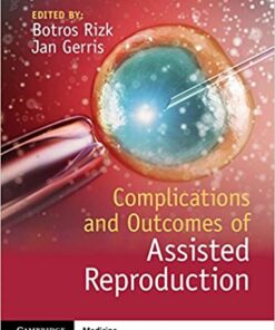 Complications and Outcomes of Assisted Reproduction PDF