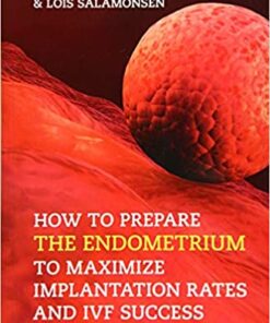 How to Prepare the Endometrium to Maximize Implantation Rates and IVF Success 1st Edition PDF