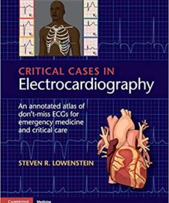 Critical Cases in Electrocardiography: An Annotated Atlas of Don't-Miss ECGs for Emergency Medicine and Critical Care 1st Edition PDF