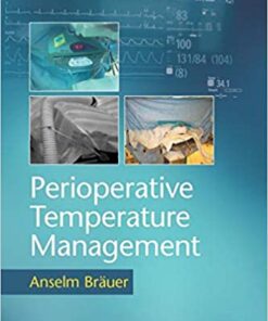 Perioperative Temperature Management 1st Edition PDF