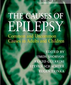 The Causes of Epilepsy: Common and Uncommon Causes in Adults and Children 2nd Edition PDF