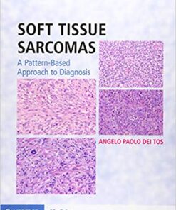 Soft Tissue Sarcomas Hardback with Online Resource 1st Edition PDF