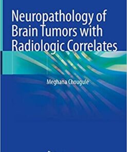 Neuropathology of Brain Tumors with Radiologic Correlates 1st ed. 2020 Edition PDF