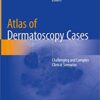 Atlas of Dermatoscopy Cases: Challenging and Complex Clinical Scenarios 1st ed. 2020 Edition PDF