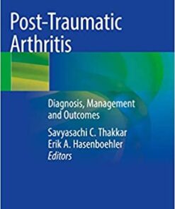 Post-Traumatic Arthritis: Diagnosis, Management and Outcomes 1st ed. 2021 Edition PDF