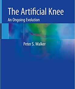 The Artificial Knee: An Ongoing Evolution 1st ed. 2020 Edition PDF