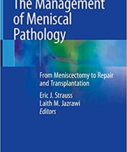 The Management of Meniscal Pathology: From Meniscectomy to Repair and Transplantation 1st ed. 2020 Edition PDF