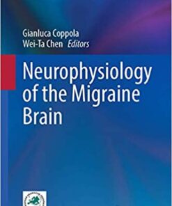 Neurophysiology of the Migraine Brain 1st ed. 2021 Edition PDF