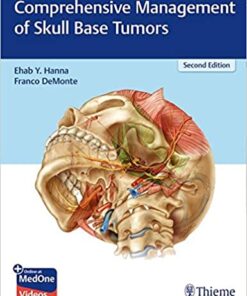 Comprehensive Management of Skull Base Tumors 2nd Edition PDF & VIDEO