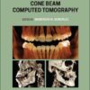 Interpretation Basics of Cone Beam Computed Tomography PDF