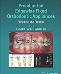 Preadjusted Edgewise Fixed Orthodontic Appliances: Principles and Practice 1st Edition PDF