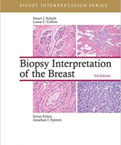 Biopsy Interpretation of the Breast 3rd Edition PDF