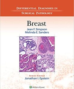 Differential Diagnoses in Surgical Pathology: Breast 1st Edition PDF