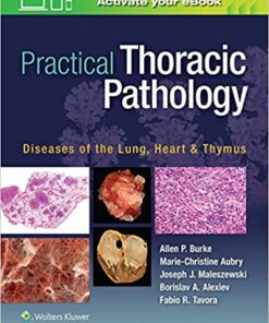 Practical Thoracic Pathology: Diseases of the Lung, Heart, and Thymus First Edition PDF