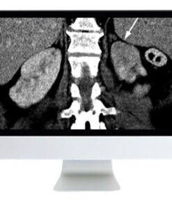 ARRS Abdominal and Thoracic Imaging Guidelines Applied: Evidence Versus Opinion 2021