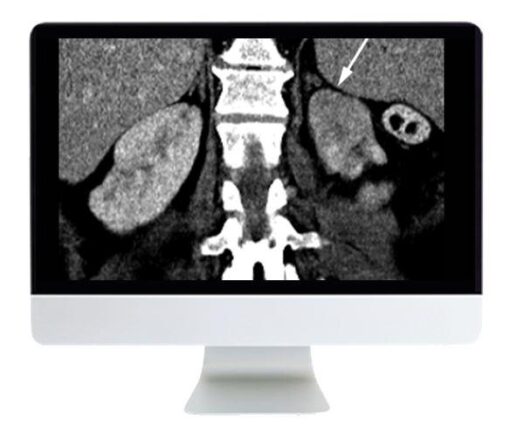 ARRS Abdominal and Thoracic Imaging Guidelines Applied: Evidence Versus Opinion 2021