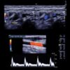 Clinical Approach to Vascular Ultrasound and RPVI Prep Course 2021