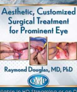 Aesthetic, Customized Surgical Treatment for Prominent Eye 2021