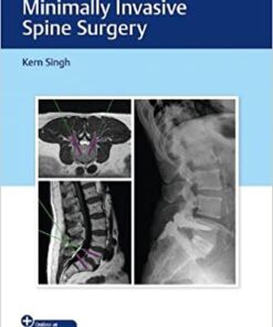 Instrumentation for Minimally Invasive Spine Surgery 1st Edition PDF