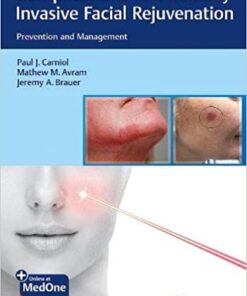 Complications in Minimally Invasive Facial Rejuvenation: Prevention and Management 1st Edition PDF & VIDEO