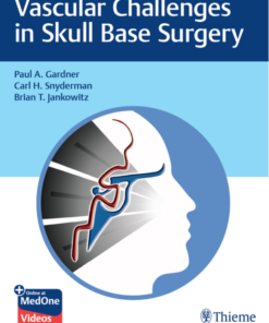 Video Vascular Challenges in Skull Base Surgery 1st Edition PDF Original & Video