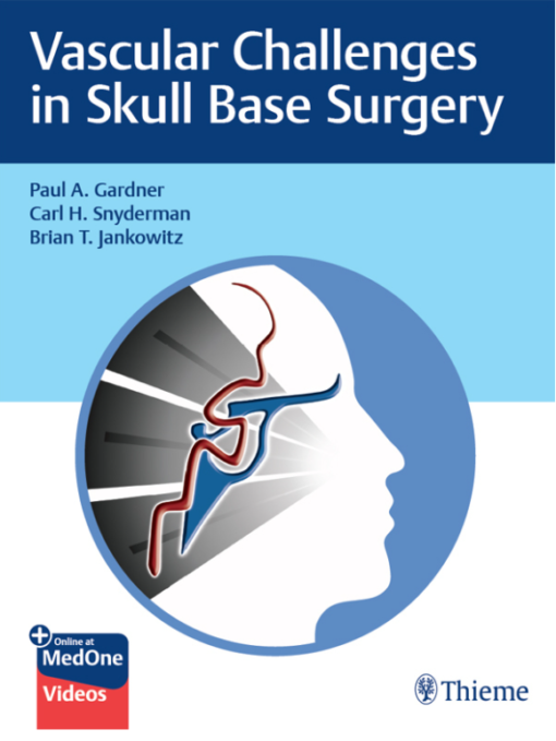 Video Vascular Challenges in Skull Base Surgery 1st Edition PDF Original & Video