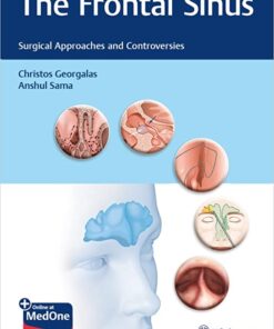 The Frontal Sinus: Surgical Approaches and Controversies 1st Edition PDF & VIDEO