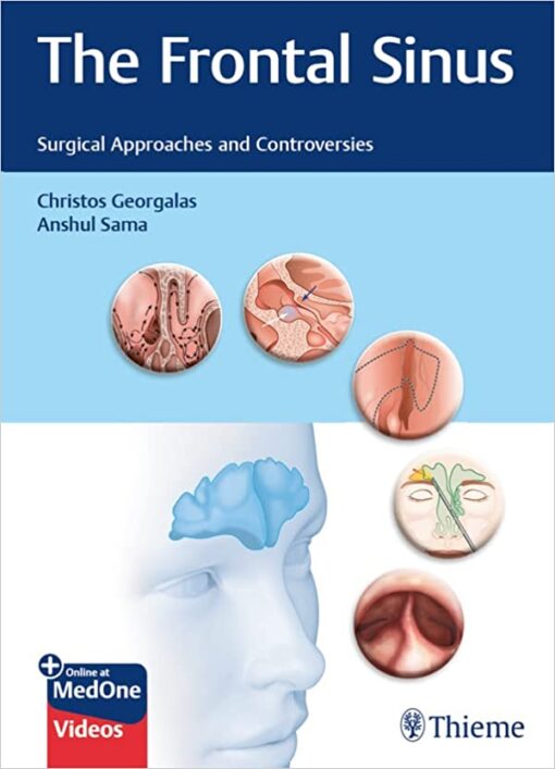 The Frontal Sinus: Surgical Approaches and Controversies 1st Edition PDF & VIDEO